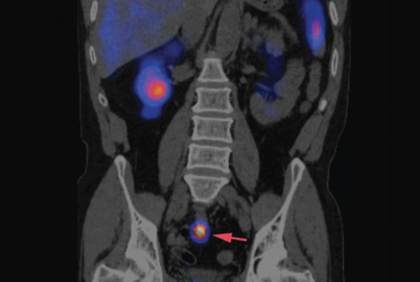 A Closer Look at Oncology Imaging