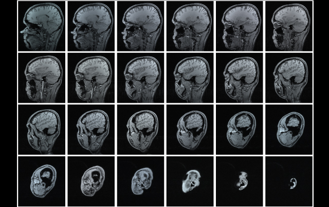 Evaluating Dizzy Patients